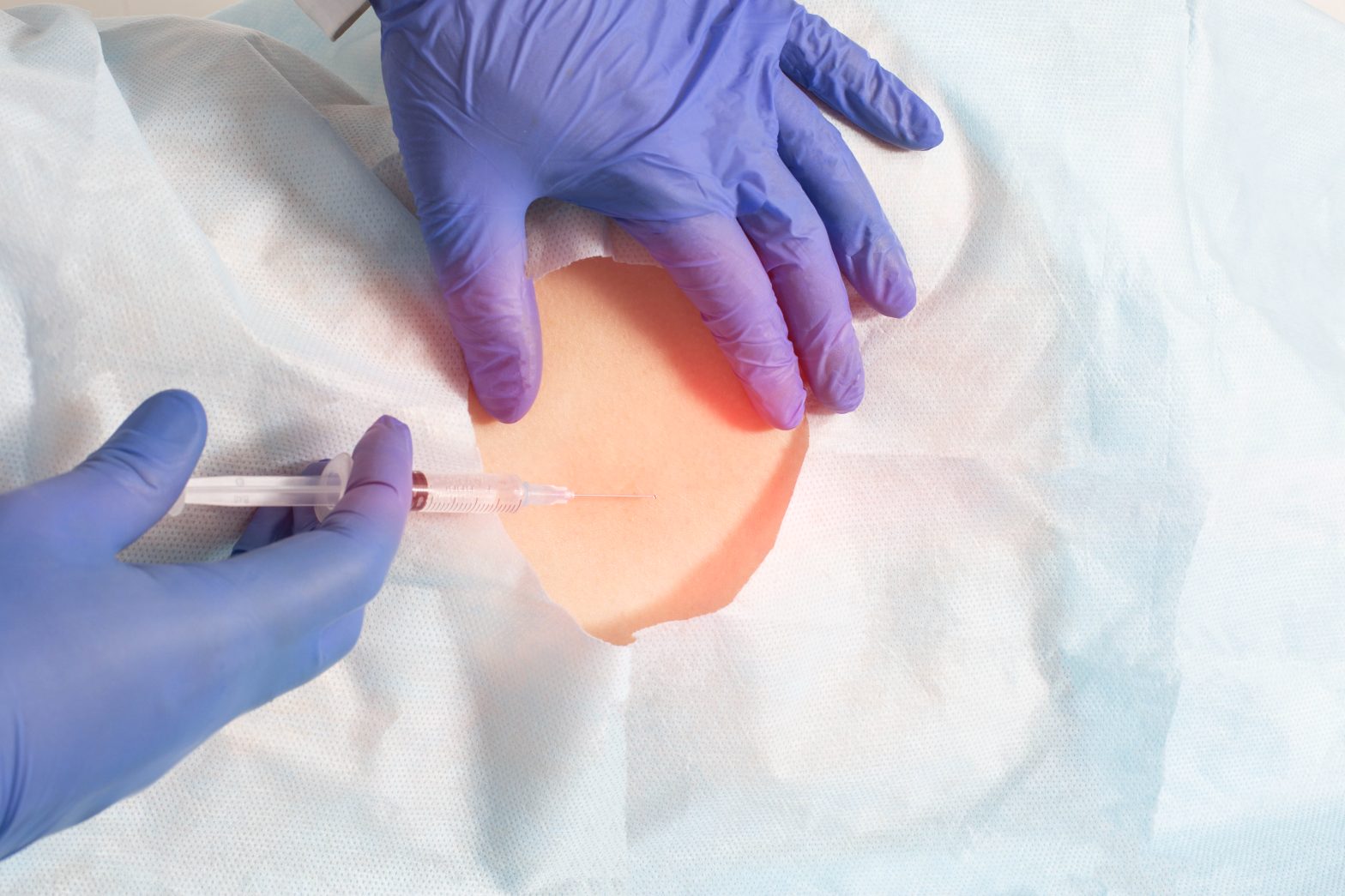 Nerve Block Therapy in Natick, Wellesley & Weston, MA