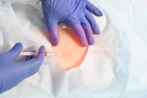Nerve Block Therapy in Natick, Wellesley & Weston, MA