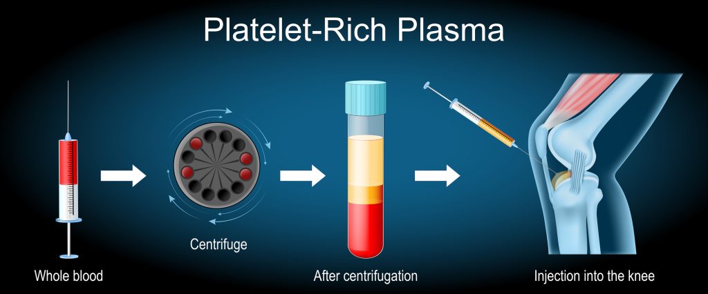 Regenerative Medicine and Orthobiologics in Natick, Wellesley & Weston, MA