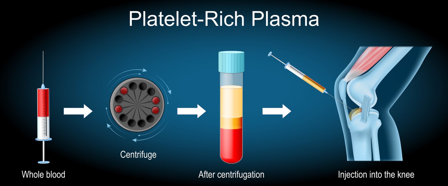 Regenerative Medicine and Orthobiologics in Natick, Wellesley & Weston, MA